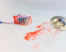 A toothbrush covered in blood over a sink with blood from bleeding gums due to gum disease