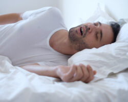 brunette man in bed snores with his mouth open as he sleeps due to obstructive sleep apnea