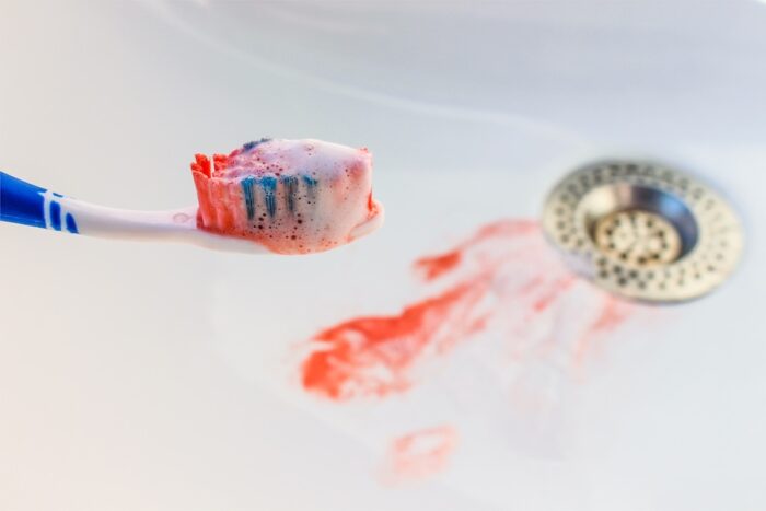 bleeding gums, pink in the sink after brushing